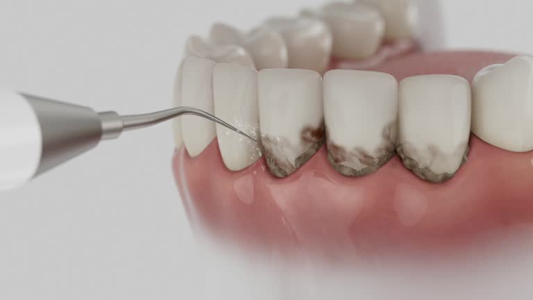 Reliable Dental Implants contractor in St. Paul, TX by Smile Center Dentistry